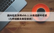 国内检出多例xbb.1.16有结膜炎症状（几种结膜炎类型症状）