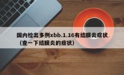 国内检出多例xbb.1.16有结膜炎症状（查一下结膜炎的症状）