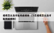 痤疮怎么治才能彻底根除（下巴痤疮怎么治才能彻底根除）