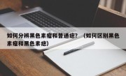 如何分辨黑色素瘤和普通痣？（如何区别黑色素瘤和黑色素痣）