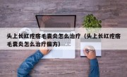 头上长红疙瘩毛囊炎怎么治疗（头上长红疙瘩毛囊炎怎么治疗偏方）