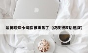 淄博烧炭小哥脸被熏黑了（烧炭被救后遗症）