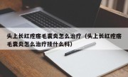 头上长红疙瘩毛囊炎怎么治疗（头上长红疙瘩毛囊炎怎么治疗挂什么科）